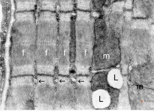  normal cardiomyocyte … longitudinal section(m … mitochondrion, f - myofilaments, L … lipid droplets, arrows … tubulesof sarcoplasmic reticulum)